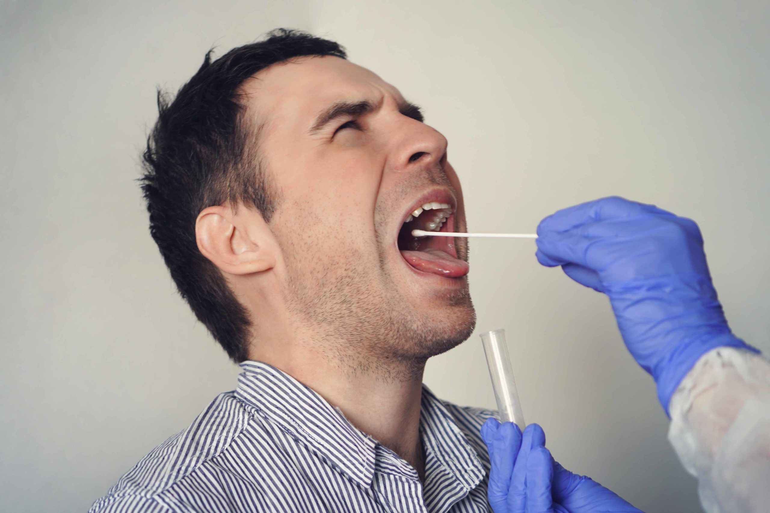CBD et test salivaire